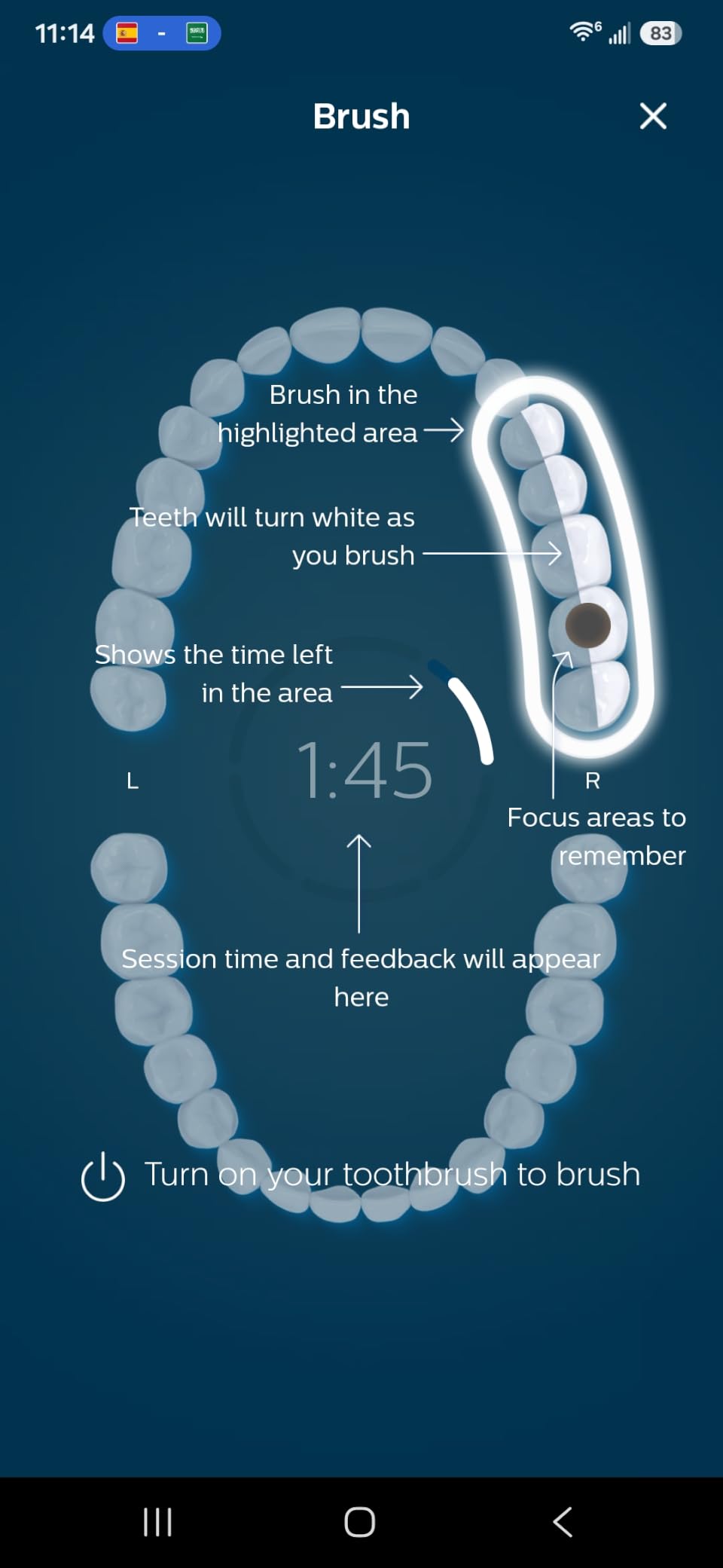 Philips Sonicare DiamondClean 9500 Electric Toothbrush 3 Brush Heads, Black customer photo 1