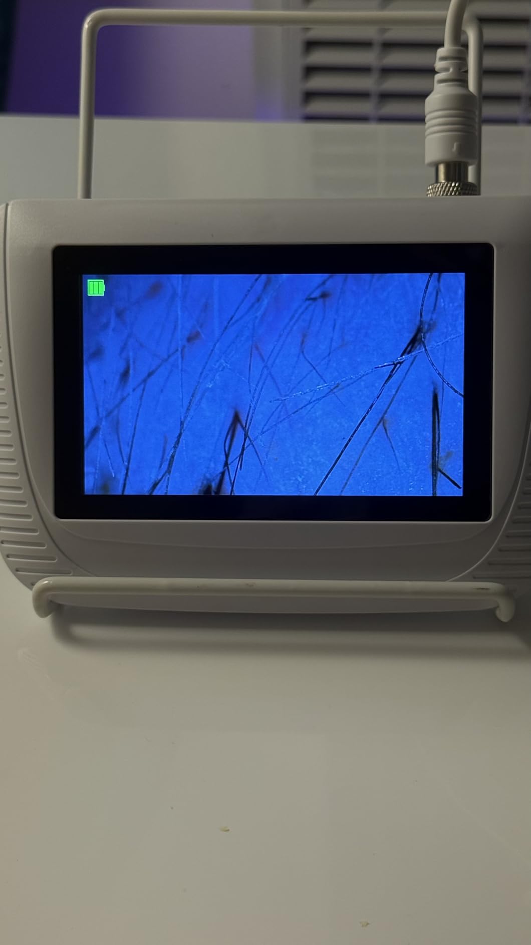 Scalp Analysis Machine, 5 Inch LCD Screen Skin Hair Analyzer customer photo 1