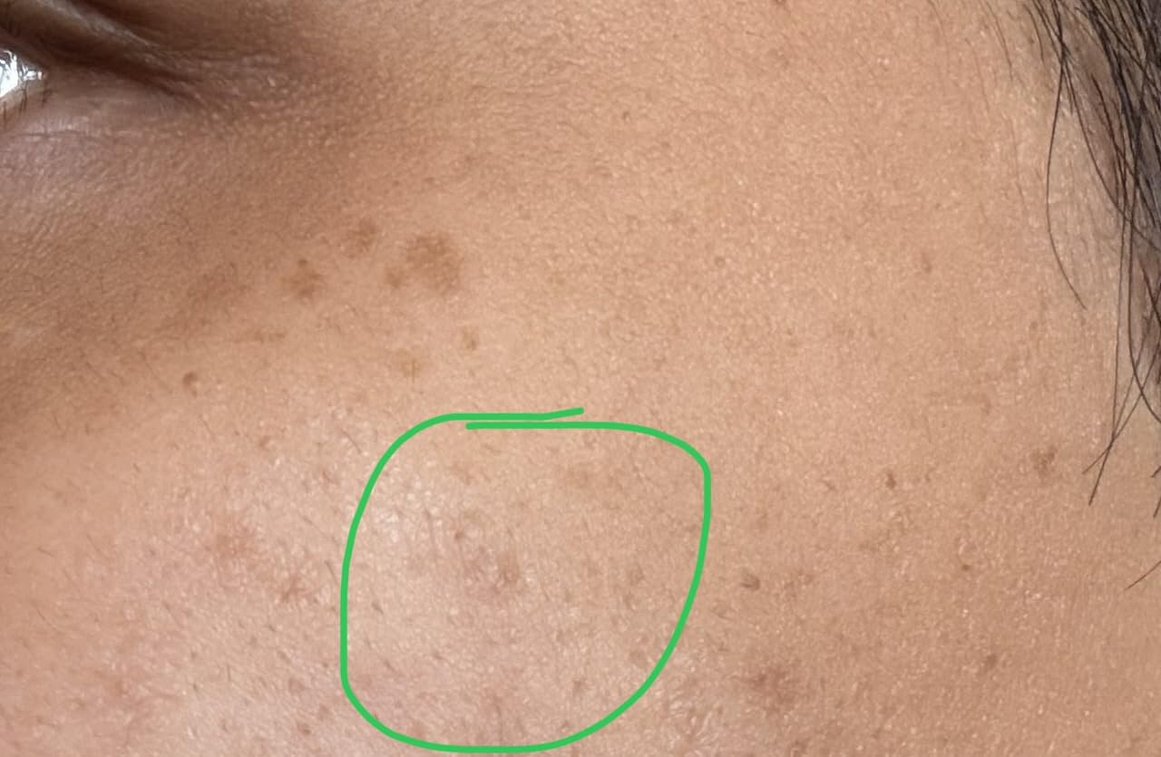 Microneedling Pen Microneedle Derma Roller Pen for Face Skin, Microneedle Micro Needle Roller 0.25mm Dermabrasion Roller for Men and Women Home Use customer photo 2