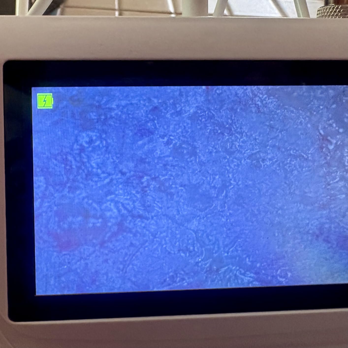 Professional Skin Hair Analyzer, Skin Scalp Analysis Machine customer photo 2