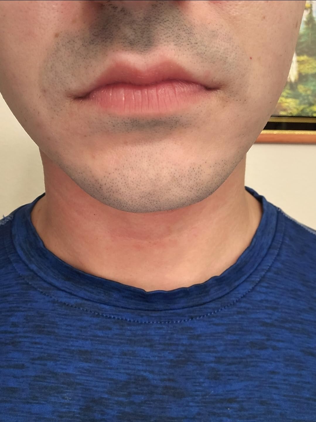 VOYOR Electric Razor for Men, Rotary Shaver, 3D Floating Heads, Wet & Dry customer photo 1